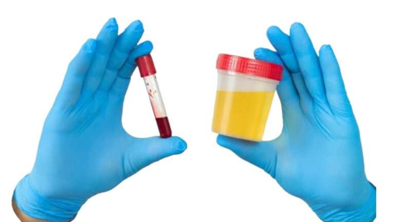 Blood in Urine