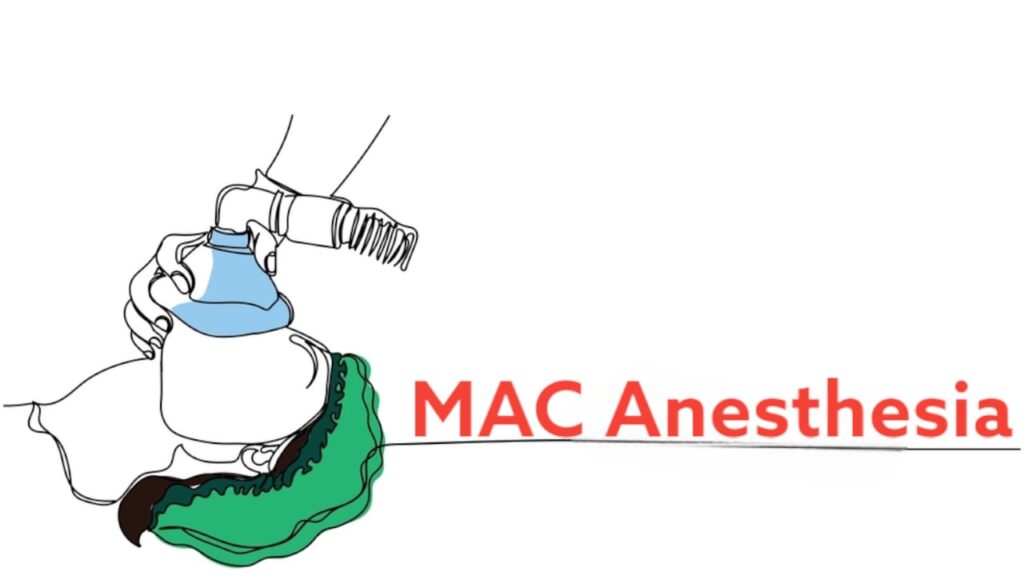 MAC Anesthesia