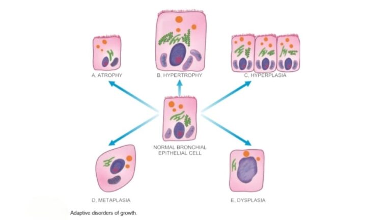 Pathogеnеsis of Cеll Injury